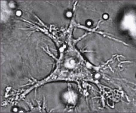 Dendritic cell from: PloS Pathogens 2007 “Environmental Dimensionality Controls the Interaction of Phagocytes with the Pathogenic Fungi Aspergillus fumigatus and Candida albicans”